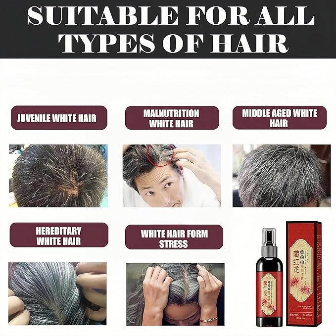 Saffron Essence Spray, Herbal Extracts Hair Serum,Lost Strengthen Hair Root, Non-Frizzy, Prevent Gray Hair (3 Pcs)