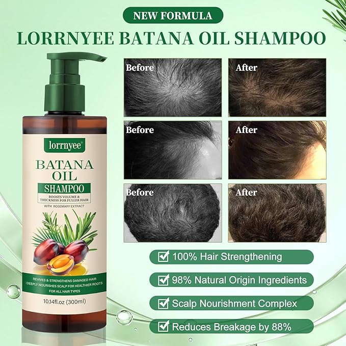 Batana Oil Shampoo, Hair Growth Shampoo for Thinning Hair & Hair Loss Treatment - Organic Rosemary, Formula with Biotin & Keratin to Reduce Shedding, Thicken Hair For Men & Women10.1oz