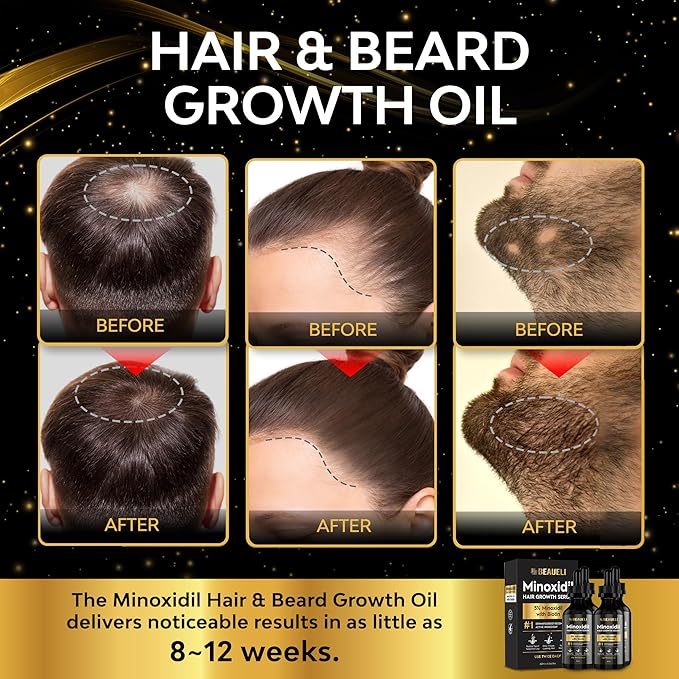 5% Minoxidil Hair Growth Serum for Men and Women: Extra Strength Minoxidil Beard Regrowth Treatment Serum with Biotin for Thinning Hair Loss to Grow Thicker Fuller 8 FL OZ (4 Bottles)