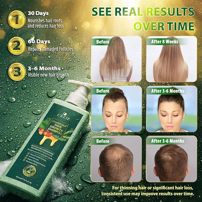 Rosemary & Batana Oil Hair Growth Shampoo: Hair Loss Shampoo for Men and Women with Biotin, Sulfate & Fragrance-Free Thickening