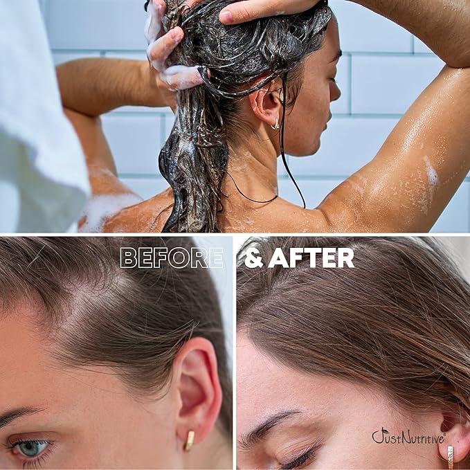 Hair Loss Shampoo | Hair Regrowth Shampoo For Thinning Hair | Hair Growth Product For Men and Women | Just Nutritive | 16 Oz