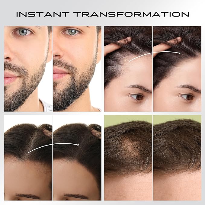 Hair Thickening Fibers for Thinning Hairline - 28g Fill In Fine or Thinning Hair - Instantly Thicker Looking - Waterproof Root Touch Up Hair Color Powder for Men & Women (Dark Brown)