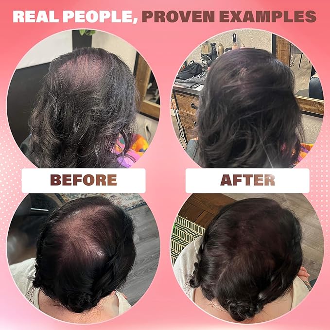 Fibers for Thinning Hair (Auburn), Undetectable Hair Powder for Women & 100% Natural Hair Building Fibers - Conceals Hair Loss - Bald Spot Cover Up Hair Powder, 2 Month Supply