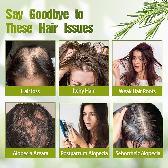 Organic Rosemary Hair Growth Shampoo, Hydrolyzed Keratin and natural extract of rosemary,Nourishes and Regenerates Hair for Thinning Hair & Hair Loss for Women and Men (Pack of 2)