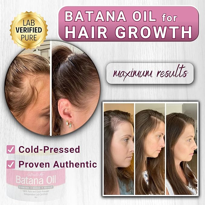 Dr. Sebi Batana Oil for Hair Growth, 100% Pure Raw & Unrefined from Honduras, Aceite de Batana Hair Growth Oil for 4C Hair - Edges, Scalp, Length
