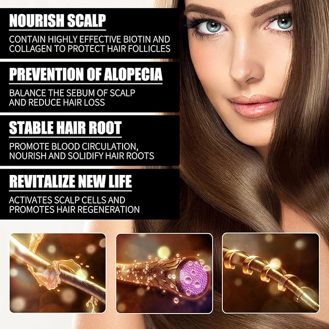 30ml Biotin & Collagen Hair Growth Oil - Scalp Treatment for Hair Loss, Anti Hair Loss Serum with Rosemary Oil & Vitamin E for Thinning Hair, Men & Women