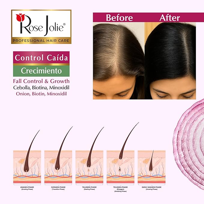 Rose Jolie Onion Conditioner | With Onion Extract and Biotin for Hair Fall Control & Growth Support| Moisturizes and Nourishes | Nourishing Daily Formula | Sulfate Free, No Onion Smell | 17 fl oz