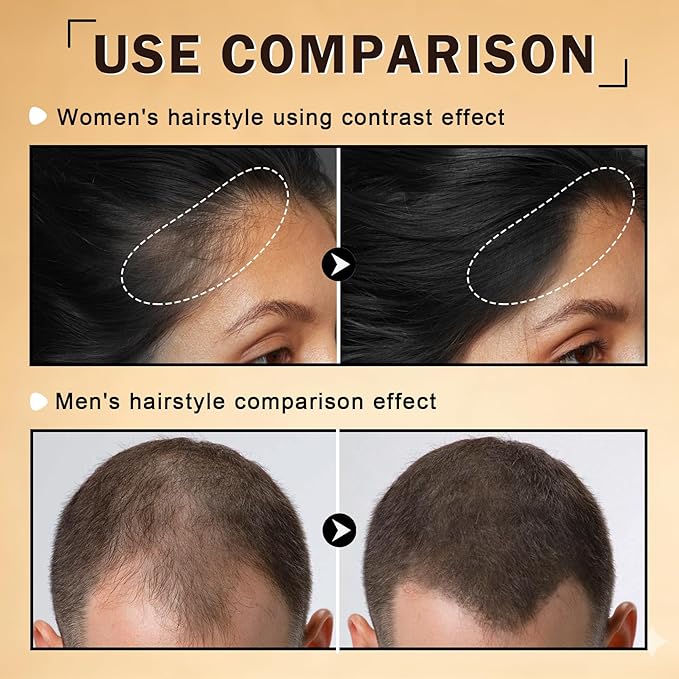 Hair Fibers for Thinning Hair for Men & Women Hair Building Fibers Instant Cover Up & Volume Instantly Hair Filler - 01 Black