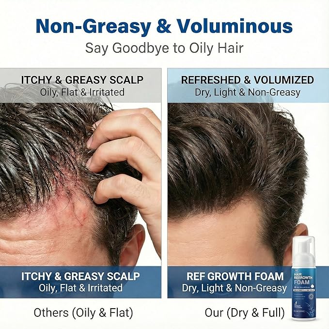 5% Minoxidil Foam for Men, Fast-Absorbing Non-Greasy Hair Regrowth Treatment for Thinning Hair & Beard, Clinically Proven, 2 x 2.11 Oz (2 Month Supply)