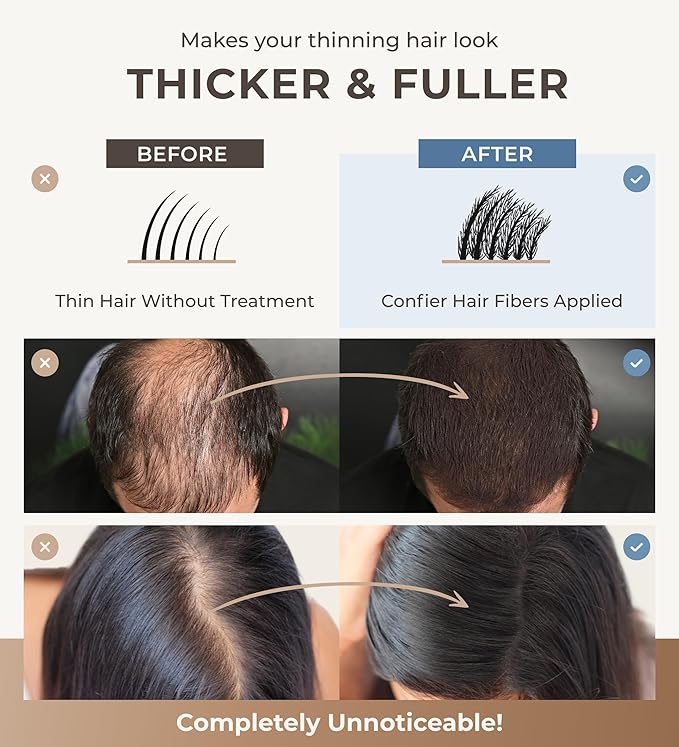 Keratin Hair Fibers for Men & Women - Fill In Fine or Thinning Hair, Instantly Thicker, Fuller Looking Hair (Dark Brown 15g)