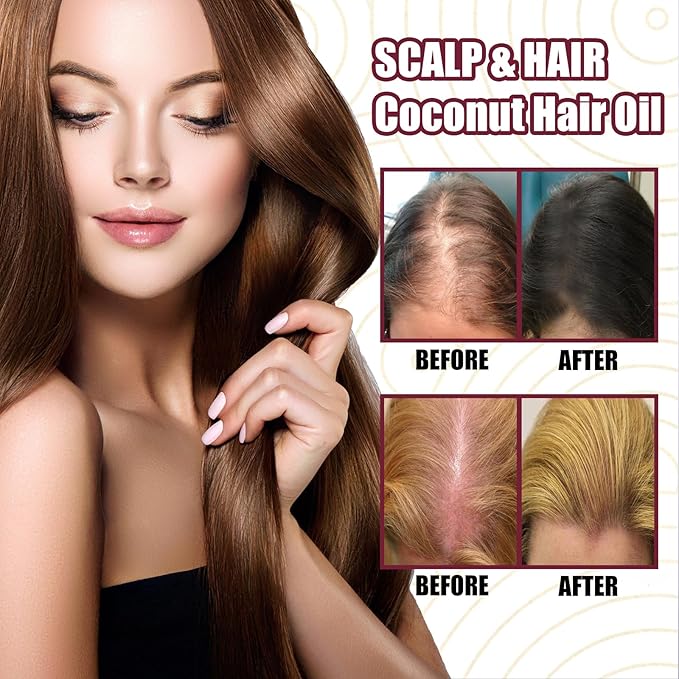 Red Onion Hair Growth Oil Spray for Hair Loss - Strengthens & Repairs Hair Follicles, Volumizes & Promotes Thicker Hair, Scalp Treatment for Men & Women, 30ml