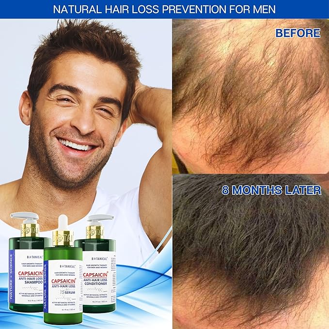 Botanical Capsaicin Shampoo for Hair Loss and Hair Thinning Oil-Free Scalp Stimulating Natural Shampoo For Men & Women 10.2 Fl Oz