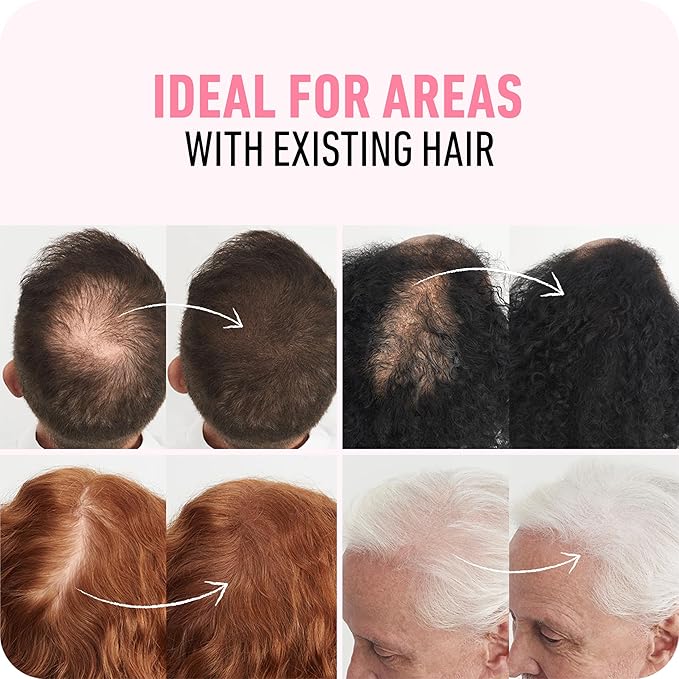 BOLDIFY Hair Fibers (2 x 56g) - Fill In Thinning and Fine Hair for an Instantly Fuller, Thicker Look - 14 Shades for Women & Men - Medium Brown