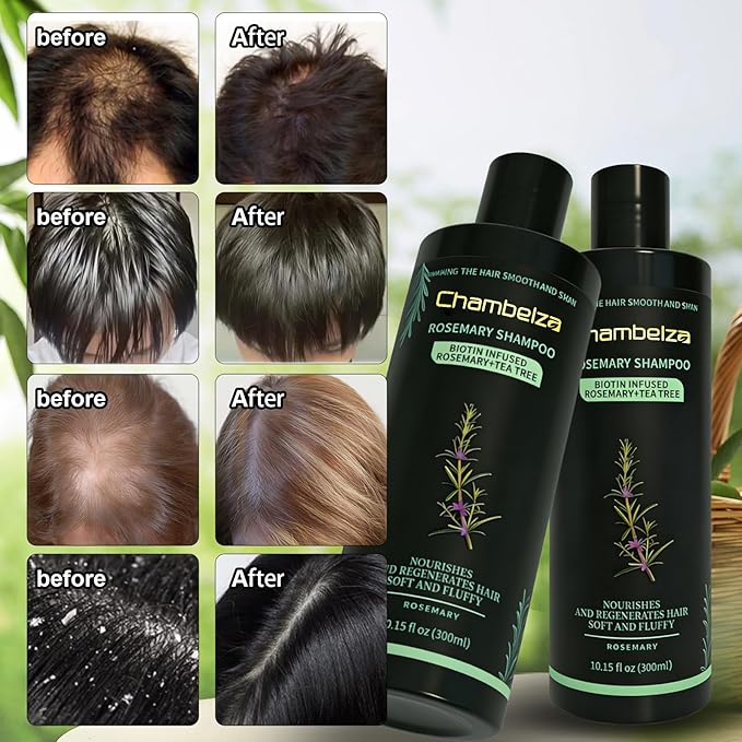 Rosemary Hair Growth Shampoo for Men and Women -Natural Thickening and Strengthening Formula with Biotin Hydrolyzed Keratin -Designed for Thinning Hair & Hair Loss 10.15 fl.oz-2 Pack