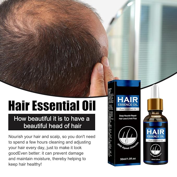 30ml Men's Hair Growth Oil for Thinning Hair – Hair Regrowth Treatment for Balding & Receding Hairline, Natural Hair Thickening Serum with Rosemary & Ginseng