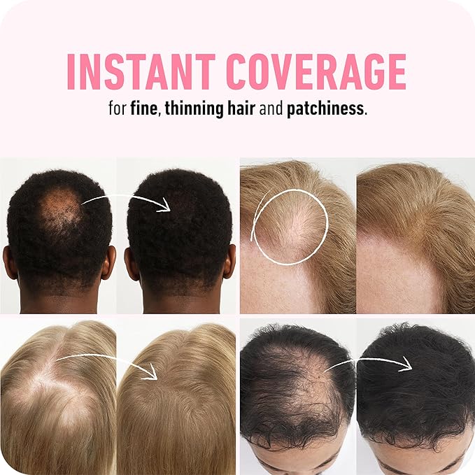 BOLDIFY Hair Fibers (2 x 56g) - Fill In Thinning and Fine Hair for an Instantly Fuller, Thicker Look - 14 Shades for Women & Men - Black