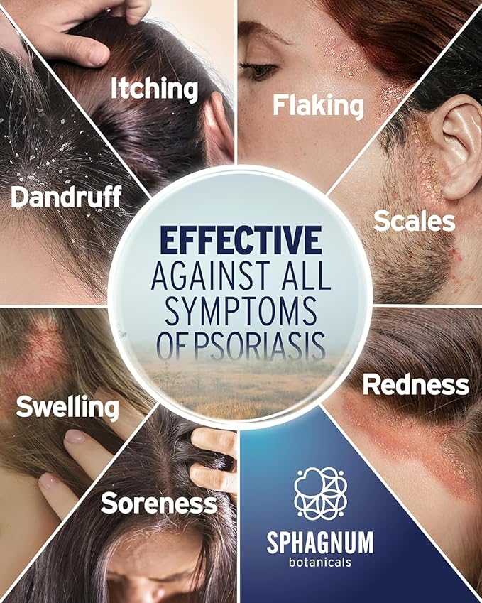 Sphagnum Botanicals Psoriasis Shampoo with Salicylic Acid – Natural Scalp Support for Dry, Itchy, Flaky Scalp with Menthol & Peat Mud – Sulfate-Free, Gentle Formula – 8.45 fl oz