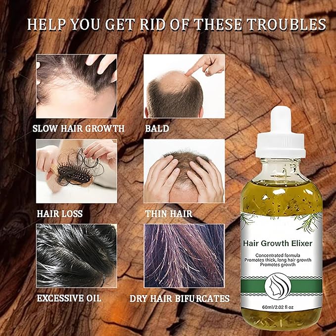 Hair Growth Serum with Rosemary Oil, Activates Follicles, Reduces Shedding & Strengthens Hair, Scalp Care Treatment for Healthier Looking Hair, 2.02 Fl Oz 2-Pack for Men & Women