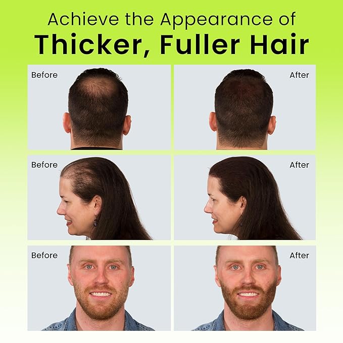 ECLIPSE Hair Fibers Black for Thinning Hair for Women & Men to Conceal Hair Loss in 15 Seconds - 100% Undetectable Hair Building Fibers, 15g