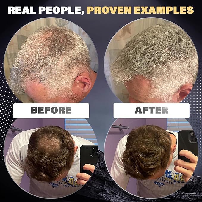 Fibers for Thinning Hair (Light Blonde), Undetectable Hair Powder for Men & 100% Natural Hair Building Fibers - Conceals Hair Loss - Bald Spot Cover Up Hair Powder, 2 Month Supply