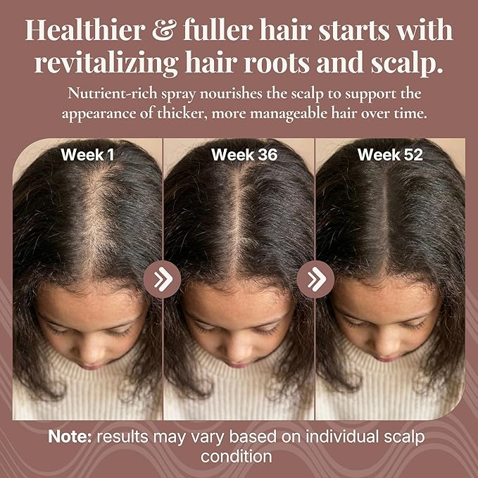 REVATOLOGY Kids Hair Roots Revitalizer Spray Gentle Botanical Scalp & Root Nutrition for Growing Children Helps Maintain Healthy Hair, Lightweight, Non-Greasy, Fast-Absorbing Made in USA – 1 fl oz