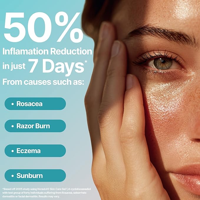 Skin Care Gel - Redness Relief Moisturizer for Dry Skin - Rosacea Treatment for Face - Soothes Prone Skin and Irritation - Fragrance Free 2 oz