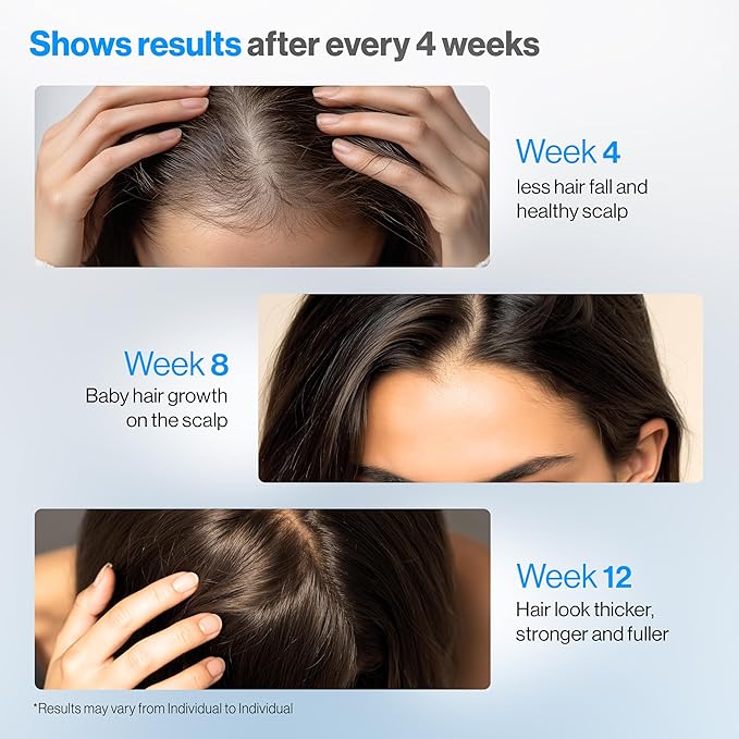 Be Bodywise Advanced Hair Density Roll-On Serum 25 ml | 5% Saw Palmetto, 3% Rosemary, 1% Caffeine Herbasome & 3% Fenugreek | Scalp Serum for Reduced Hair Fall | Men & Women