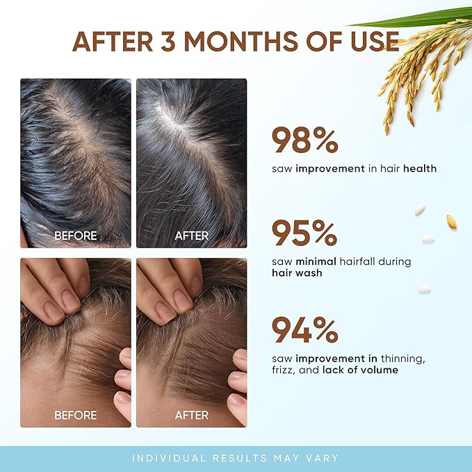 Svvimer Rice Water Hair Growth Shampoo - Thickening Shampoo with Biotin for Hair Loss and Thinning Hair