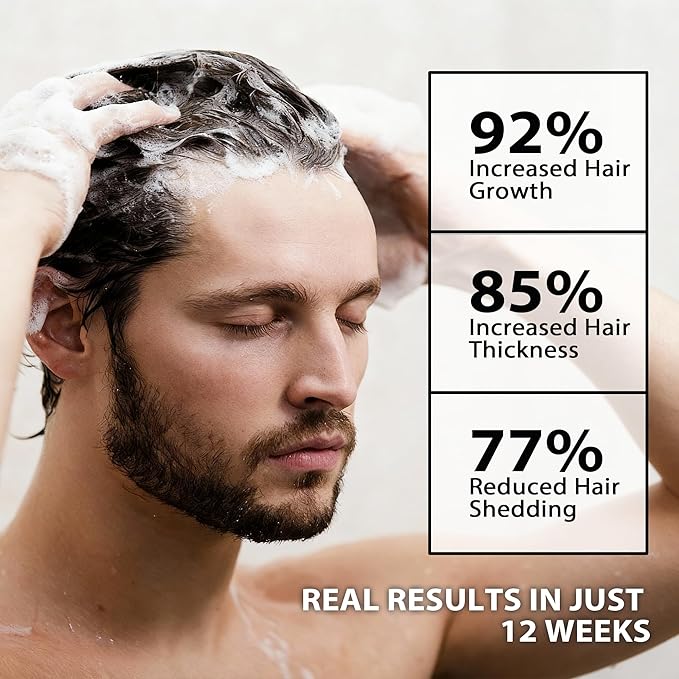 Root Activator Shampoo for Men-Hair Growth Shampoo for Hair Loss and Thinning Hair,Sulfate Free-13.6 fl oz / 400 mL