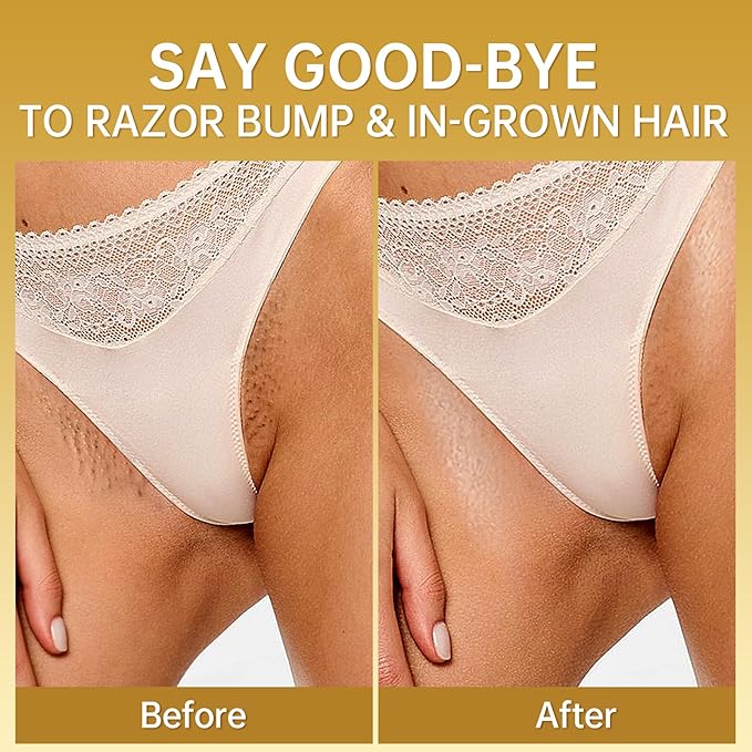 LA.PERSONAL Ingrown Hair Treatment, Razor Bump Treatment for Men and Women, Razor Bump and Burn Remover Ingrown Hair Oil for Bikini Area, Legs and Underarm Area After Shave 40 ML/1.4 FL OZ