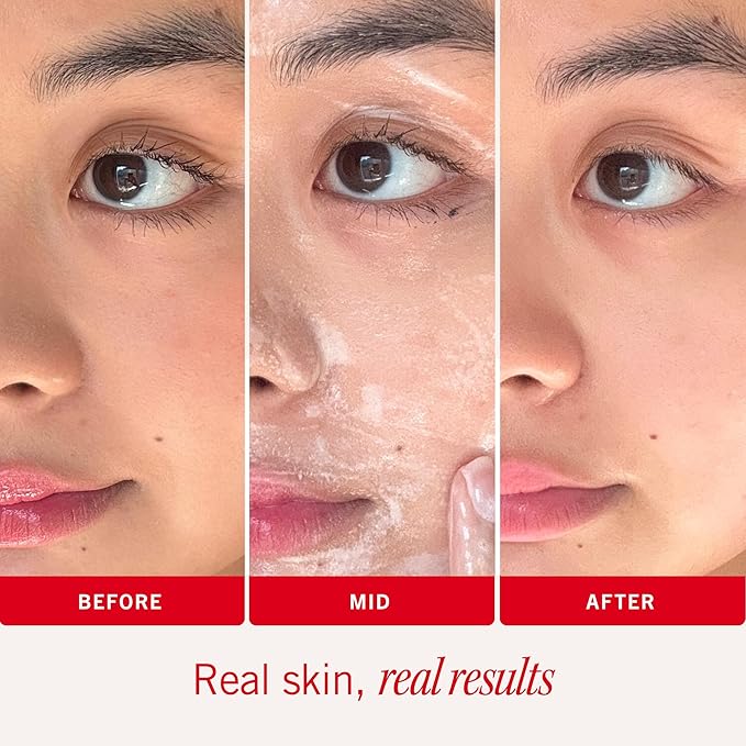 First Aid Beauty Ultra Gentle Cream-to-Foam Facial Cleanser – Makeup Removing Face Cleanser - Face Wash with Colloidal Oatmeal & Glycerin, for Sensitive, Acne & Blemish-Prone Skin, 10 oz