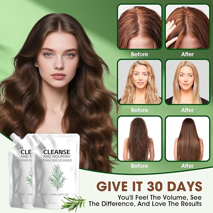 2PCS Rosemary Amino Acid Shampoo, Hair Growth Shampoo for Thinning Hair Women and Men Hair Loss, Strengthening Hair with Natural formula (3.38 fl.oz)