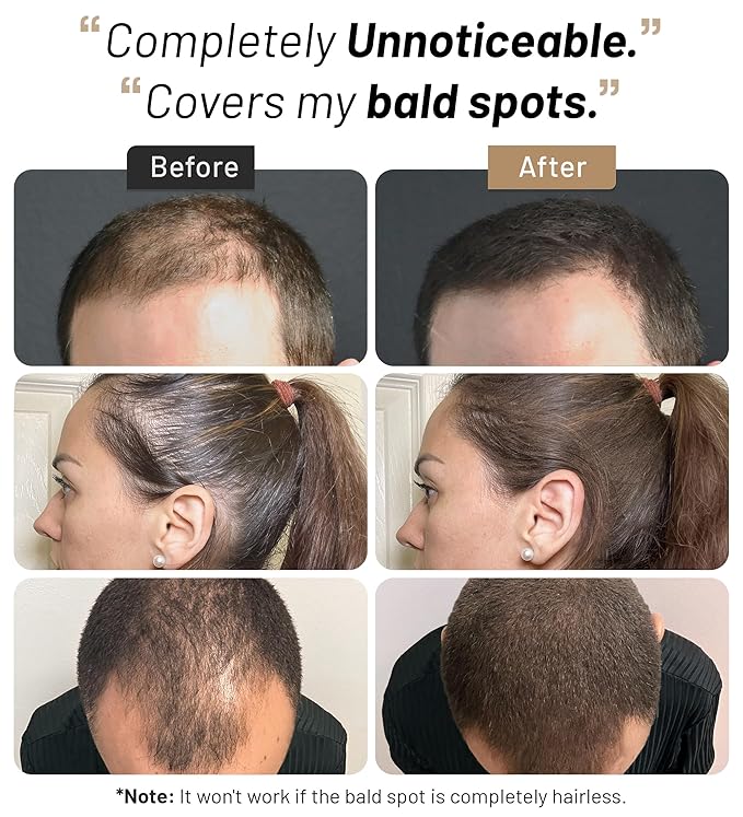 Hair Fibers for Men & Women (30 Grams, White), Fill In Fine or Thinning Hair, Instantly Thicker, Fuller Looking Hair
