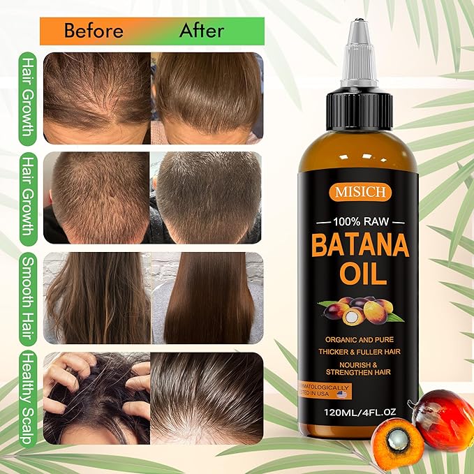 Raw Batana Oil, 100% Natural Organic Hair Growth Oil for Men & Women, Sourced from Honduras, Pure, Unrefined, Enhances Thickness, Prevent Hair Loss 4 Oz