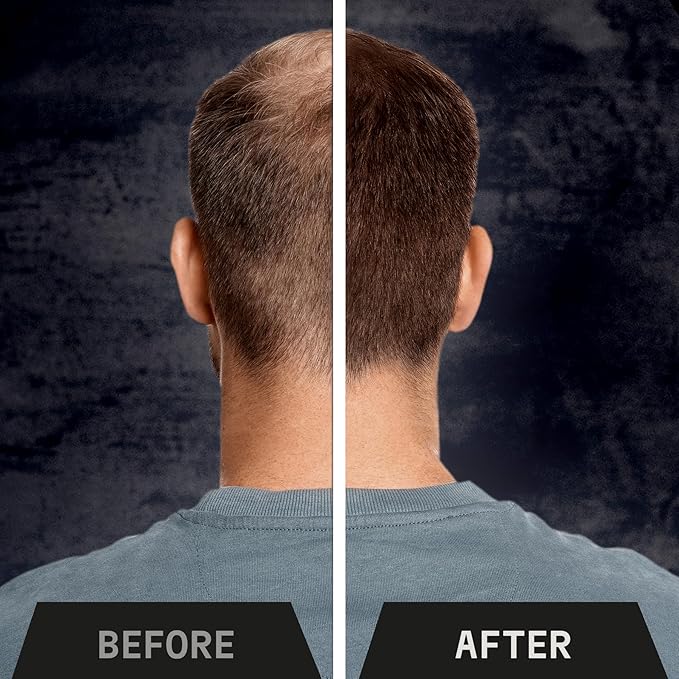 Striking Viking Hair Building Fibers - 28g, Black - Fuller Look Thinning Hair Fibers - Bald Spot Concealer & Barber Enhancement - Clump-Proof Powder & Hold Spray