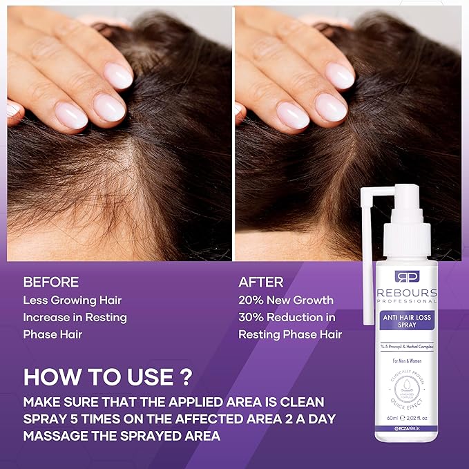 Hair Regrowth Treatment with 5% Procapil – Anti Hair Loss & Hair Growth Spray for Stronger, Fuller Hair – Residue-Free Formula – Suitable for All Hair Types (Pack of 4)