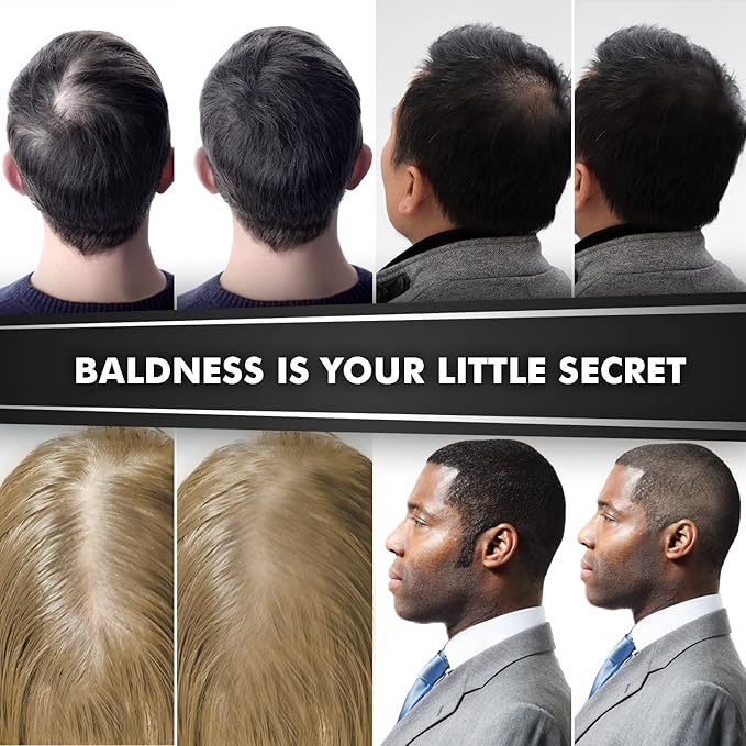 Hair Fibers for Men & Women (30 Grams, White), Fill In Fine or Thinning Hair, Instantly Thicker, Fuller Looking Hair