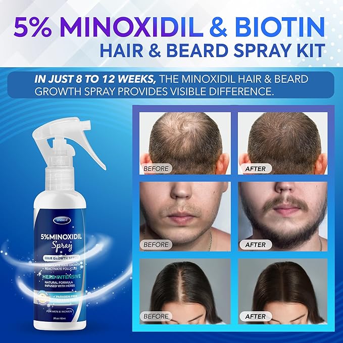 5% Minoxidil Hair Regrowth Spray : Minoxidil for Women Hair Growth Treatment, Minoxidil 5 percent for Men Beard Growth - 60ml