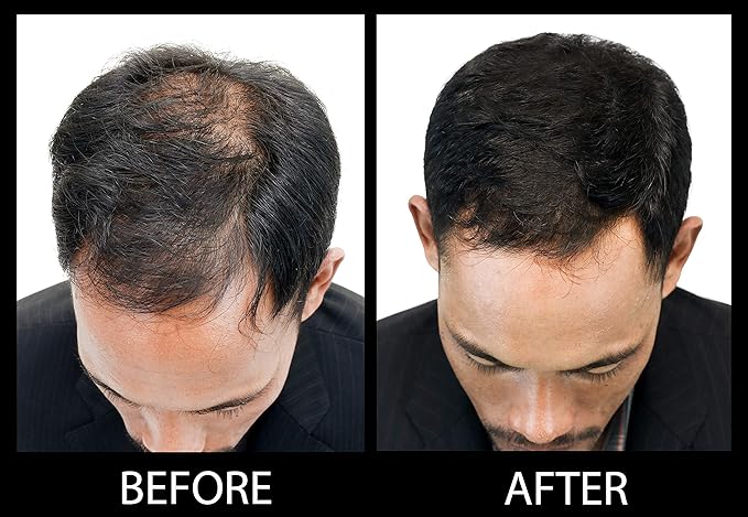 Volumizing Hair Fibers with real Keratin for Thinning Hair/Hair Loss – Dermatologist Tested and Certified Hypoallergenic - 60 days + supply - Multiple Colors Available (Black)