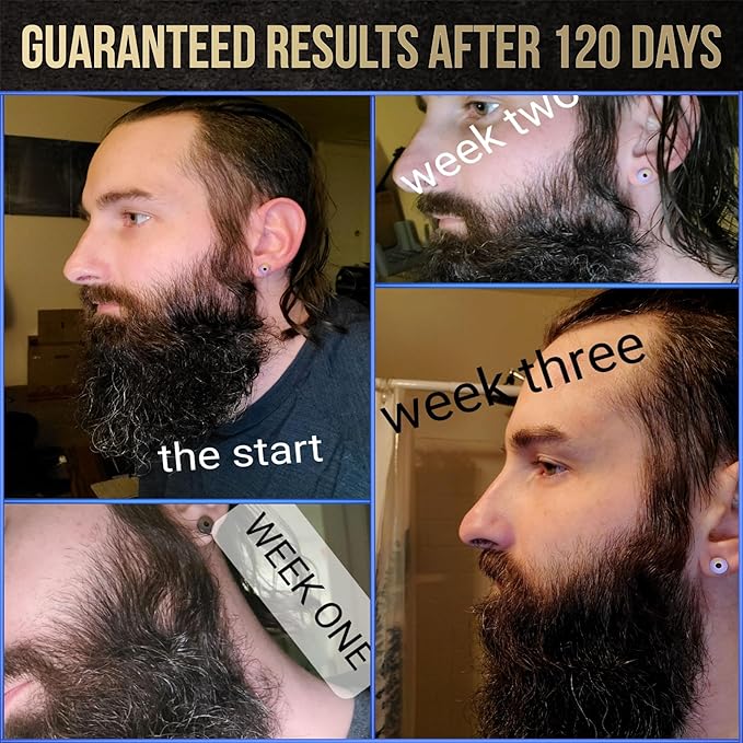 The Beard Struggle Voxtr Beard Growth Serum with Follicle Acceleration Matrix - Beard Serum, 1.69 Fl. Oz. US