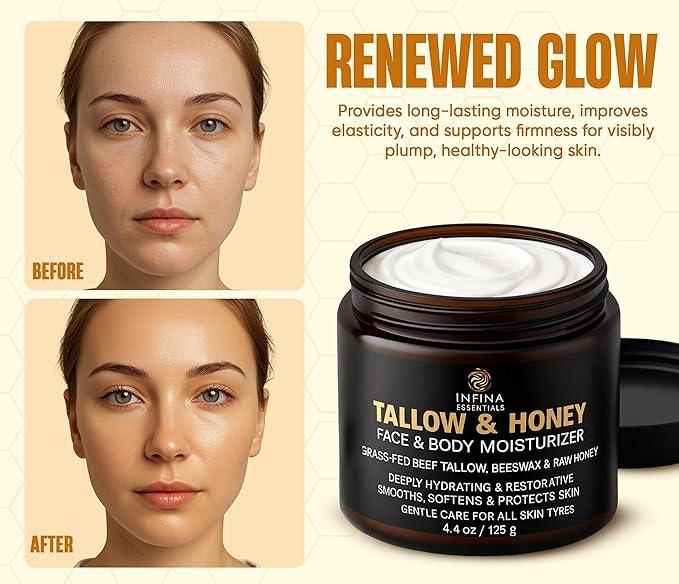 Beef Tallow for Skin with Raw Honey – Grass Fed Beef Tallow Face & Body Moisturizer - Balm Style Hydrating Cream with Beeswax & Olive Oil for Dry Skin, Hands & Feet – 4.4 oz