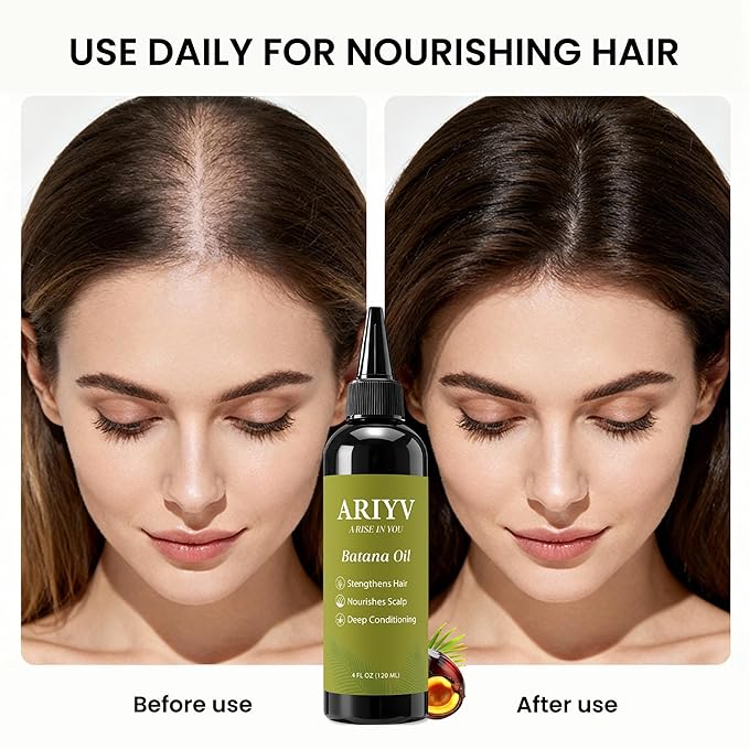 Batana Oil for Hair Growth, Natural Batana Oil - Prevents Hair Loss, Reduces Breakage and Strengthens Hair, Enhances Thickness for Men & Women