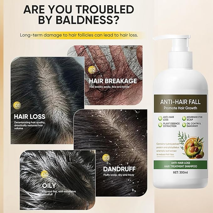 10.14 fl Oz Anti Hair Loss & Hair Fall Shampoo for Women - Daily Routine Shampoo to Strengthen Roots, Prevent Hair Loss & Nourish for Voluminous, Hydrated Hair