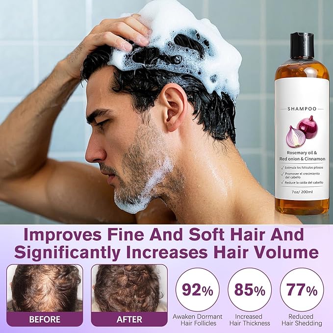 Rosemary Shampoo with Onion & Biotin,Shampoo,With Rosemary Oil, Red Onion, Cinnamon, Effectively Prevent Hair Loss,Support Hair Regrowth For Women Men