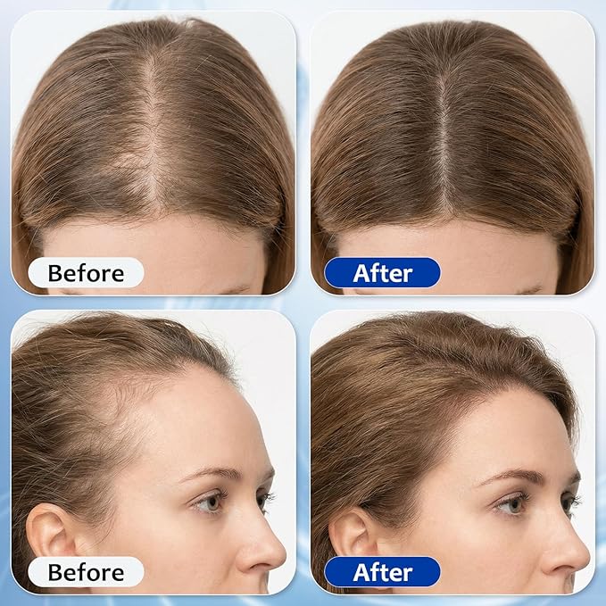 Hair Growth Serum Roll On with 3% Rosemary,3% Batana Oil,2% Pea Extract,2% Ginger Root Oil,Stronger Root,stimulate follicle,Hair Thicker,Hair Loss Treatment,Hair Growth Serum(30ML/1.01FL.OZ)