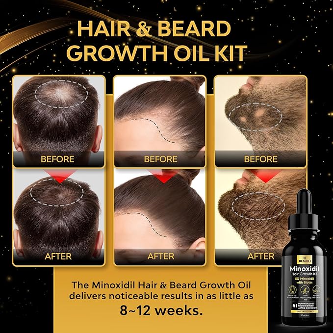 Minoxidil Beard Growth Kit For Men and Women, Hair Loss and Hair Regrowth Treatments, Minoxidil 5%, Black