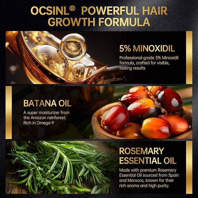 Minoxidil for Men & Women, With Biotin, Batana Oil, Rosemary Essential Oil, Effective Hair Loss Solution, Hair Loss Treatment for Hair Regrowth, Non-Greasy 5% Minoxidil - 60ml(Serum + Massager Set)