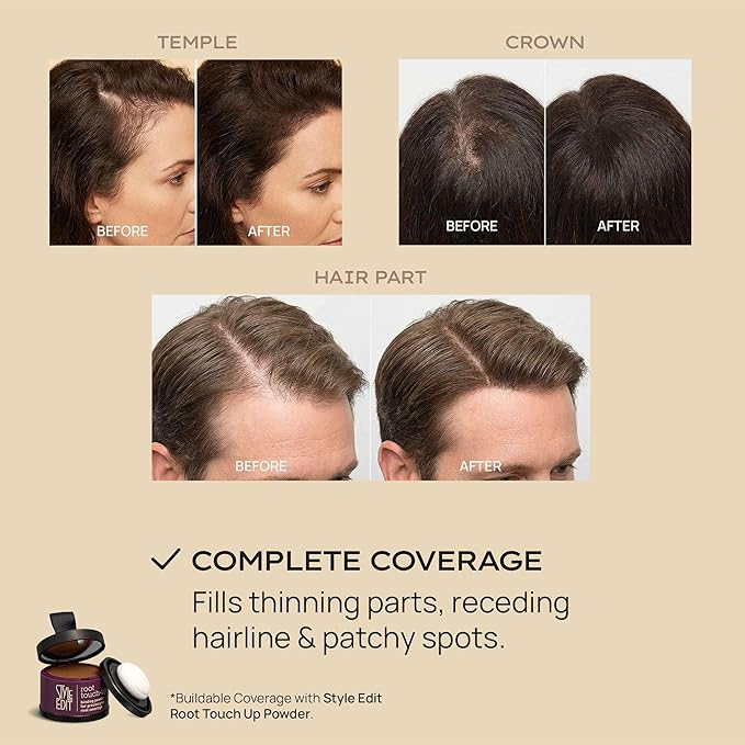 Style Edit Hair Building Fibers for Thinning Hair | Conceals Receding Hairlines, Fine Hair & Bald Spots for Fuller looking hair, 100% Plant-Based Thickening Powder for Men & Women, Black 0.88oz