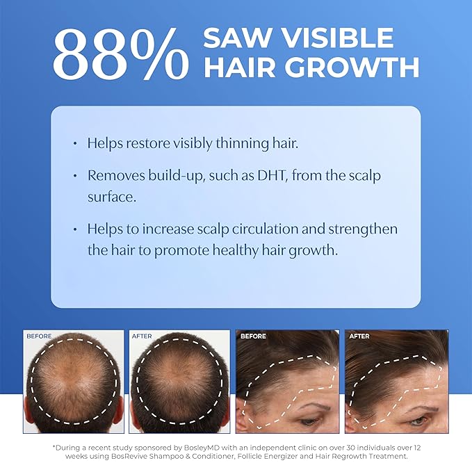 BosRevive Nourishing Shampoo for Noticeably Thinning, Non Color-Treated Hair – Helps Restore Thinning Hair & Remove DHT, Product & Pollution Build-Up, Boosts Scalp Circulation, Sulfate-Free 33.8 Fl Oz