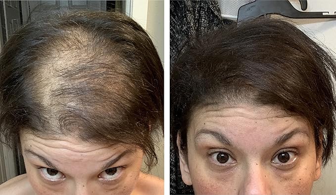 Caboki Hair Fibers for Thinning Hair – Natural Plant-Based Hair Powder for Men & Women – Instantly Thicker Fuller Looking Hair – Wind & Sweat Resistant – 30g, 90-Day Supply, Dark Brown